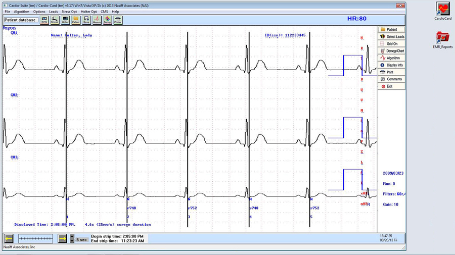 PC based Cardio Holter 12 Leads 